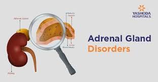 Since adrenal insufficiency causes chronic fatigue and stress on the body, it makes sense to address the lifestyle habits that have led us to that point. Adrenal Gland Disorders Types Causes Symptoms Diagnosis Treatment And Complications