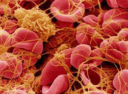 What We Know About The Astrazeneca Vaccine And Blood Clots Curious