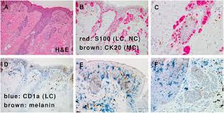 A merkel cell is a touch receptor found in the skin. Langerhans Cells And Merkel Cells In The Epidermis A Skin Of Download Scientific Diagram
