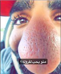 خشم كبير مضحك