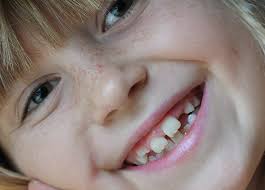 Je reste de marbre malgré les explosions de plaisir qui parcourent mes veines. Faire Tomber Les Dents De Lait En Douceur Picou Bulle Blog De Maman Decomplexe Et Bienveillant Lyon