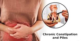 Image result for Chronic Constipation