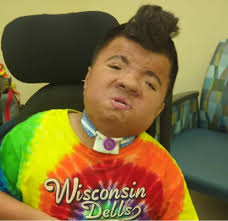 Chromosome 3q22.2‐q26.2 Interstitial Deletion in a Patient With Wisconsin  Syndrome, Blepharophimosis‐Ptosis‐Epicanthus Inversus Syndrome,  Dandy‐Walker Malformation, Pierre Robin Sequence, and Recurrent Infections 