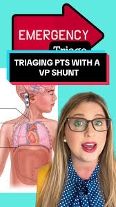 Emergency Nyc Vp Shunt