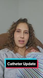 Colostomy Bag for Pd Catheter