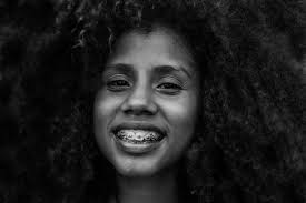 Teeth whitening toothpastes keep a great importance in whitening your teeth when done regularly. How Long Do Braces Take To Work Swish Dental Brisbane