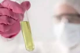 As workforce positivity rates continue to rise, are the same trends reflected in life insurance drug use positivity rates? Life Insurance Drug Tests What Re Checked And How To Pass Those