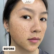 Jolie Skincare Spa