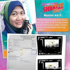 Makan mencangkung payah dapat rezeki. Hyperthyroid Stabil Dengan Shaklee Pengedar Shaklee Shah Alam