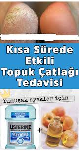 Pin On Cilt Bakimi