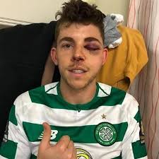 Rory McLaughlin (@Rory_McL14)