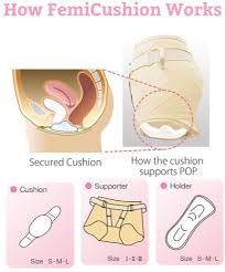 Using The Cushion Supporter And Holder Femicushion Provides Natural Relieve To Prolapsed O Pelvic Organ Prolapse Symptoms Pelvic Organ Prolapse Pelvic Floor