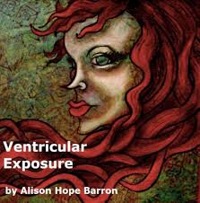 Ventricular Exposure