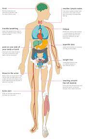 The likelihood that kidney cancer will spread to other organs and tissues depends on the size and histology, as well as other individual factors. The Effects Of Metastatic Renal Cell Carcinoma On The Body