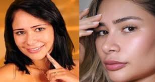 Ex-BBB Jake Leal detalha procedimento que promove "emagrecimento facial"