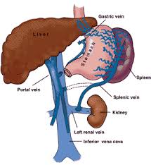 How do you spell spleen? Distal Splenorenal Shunt