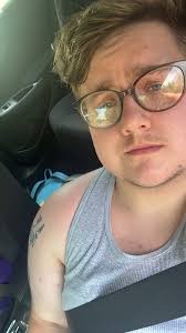 I was diagnosed with Autism last July (mid 40's). my brain is taking a long  time to come to terms with this and accept the YEARS of struggle and being  misdiagnosed /