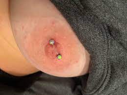 How do i know if my nipple piercing is rejecting