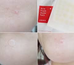 What works wonders for some, may not for others. A Cynful Fiction Pimples Then You Need This Product