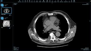 Maybe you would like to learn more about one of these? Top 25 Free Dicom Viewers For Doctors Medical Students And Health Professionals Postdicom