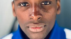 SFX3Prothèses Transferts