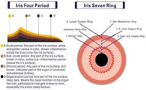 Details About Iridology Chart Iriscope Camera 12 Mp Mega Pixels Cadi Iris Analyzer Pro V 2 264