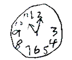 Montreal cognitive assessment performance in patients with parkinson's disease. Scoring The Mini Cog C Mini Cog C