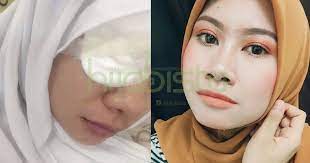 Tapi cik en terpaksa sebabnya nak control power itu naik sampai beribu cara merawat kucing lemah kerana sakit | cik en perasaan ada keyword cara merawat kucing lemah yang terlekat di blog cik en ini. Hampir Buta Gara Gara Contact Lens Gadis Ini Kongsi Cara Penjagaan Contact Lens Yang Tepat Mengikut Saranan Doktor Pakar Mata Hijabista