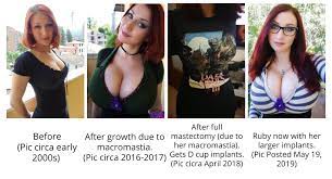 Ruby's Breast Growth Timeline [more in comments] : r/PureRuby87