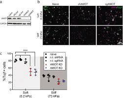 Suggestions will appear below the field as you type. Angiomotin Links Rock And Yap Signaling In Mechanosensitive Differentiation Of Neural Stem Cells Molecular Biology Of The Cell