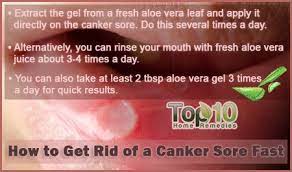 How To Get Rid Of A Canker Sore Fast | Top 10 Home Remedies