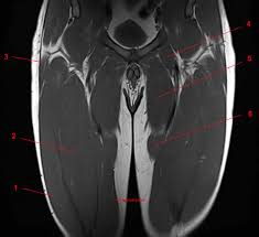 The muscles of the thigh and lower back work together to keep the hip stable, in alignment, and able to move. Mri Of The Thigh Detailed Anatomy Superior Part W Radiology