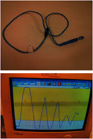 You can't find this ebook anywhere online. The Top Image Shows An Anal Plug Emg Electrode The Bottom Image Shows Download Scientific Diagram
