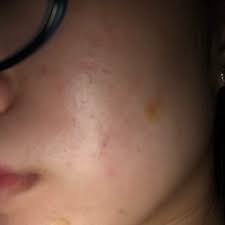 Take a moment to close your do some areas feel rougher than others? Uneven Skin Texture Korean Beauty Amino