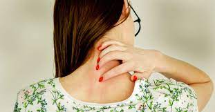 Du kan søke i fritekst, men ikke alle ord i basen er søkbare. Mosquito Bite Allergies Symptoms And Treatment
