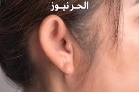 ماذا يعني نزول ماء من الاذن وهل هذا خطر