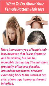 What Is Female Pattern Hair Loss Fphl Female Pattern Hair Loss Is A Form Of Hair Loss It Cause Female Pattern Hair Loss Thin Hair Problems Hair Loss Women