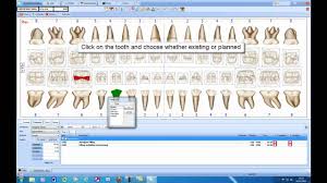 Dental Tooth Charting Exercises Dental Tooth Charting