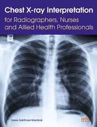 Images are from different subjects affected by pneumonia (2561. Chest X Ray Interpretation For Radiographers Nurses And Allied Health Professionals Karen Sakthivel Wainford 9781910451274 Amazon Com Books