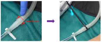 Image result for Small Caliber Chest Tube