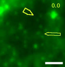 212 videos about plant cell at clipdealer. Evolutionarily Unique Mechanistic Framework Of Clathrin Mediated Endocytosis In Plants Elife