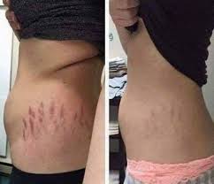 Pin On Skin Care Routine