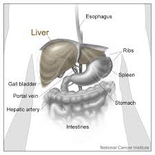 Liver picture, diagram locating liver pain. Liver Cancer Cancerquest
