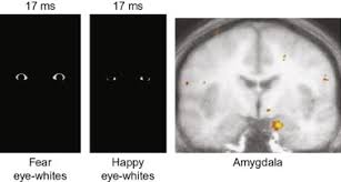 Kluver Bucy Syndrome An Overview Sciencedirect Topics
