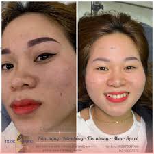 Ngọc Hưng Beauty Center