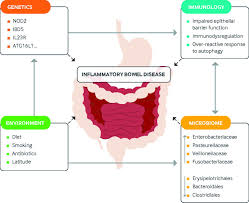 Diagnosis And Management Of Inflammatory Bowel Disease In Children The Bmj