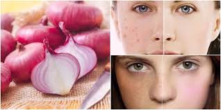 Củ Hành Tím Có Tác Dụng Gì