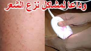 علاج حبوب المنطقة الحساسة المؤخرة بعد ازالة الشعر إزالة الحبوب واحمرار الجلد بعد نزع شعر العانة Youtube