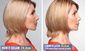 How do you grow your hair very long and thick? Fast Fortified Amino Scalp Therapy Shampoo Promises To Make Your Hair Grow Faster Daily Mail Online