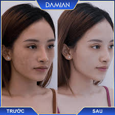 Viên Uống Trắng Da Damian